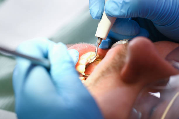 Best Emergency Dental Services for Seniors in Saratoga, CA