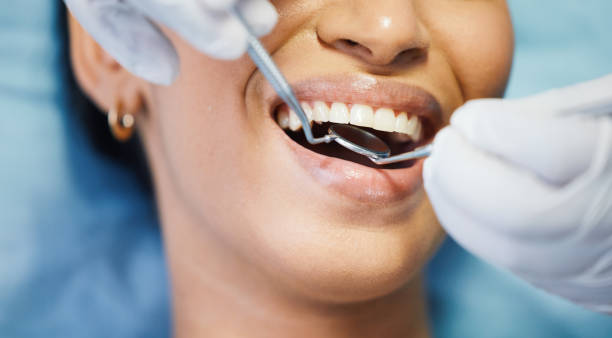 Best Broken or Cracked Tooth Emergency Dentist in Saratoga, CA